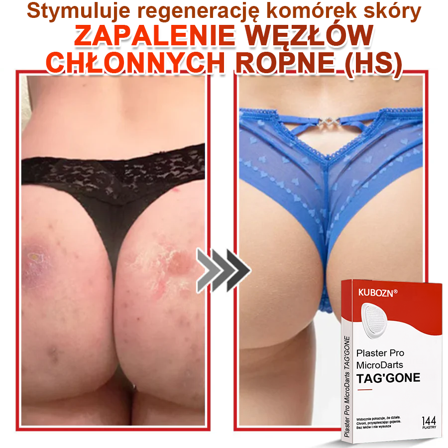 🌈 KUBOZN® mikrotűs botanikai tapasz a bőr szemölcseinek eltávolítására