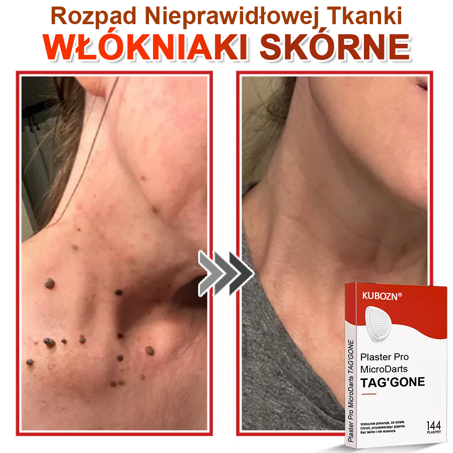 🌈 KUBOZN® mikrotűs botanikai tapasz a bőr szemölcseinek eltávolítására