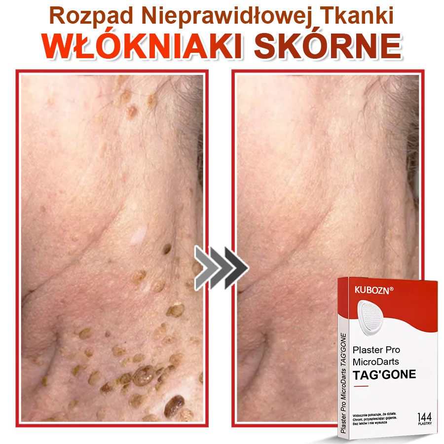 🌈 KUBOZN® mikrotűs botanikai tapasz a bőr szemölcseinek eltávolítására