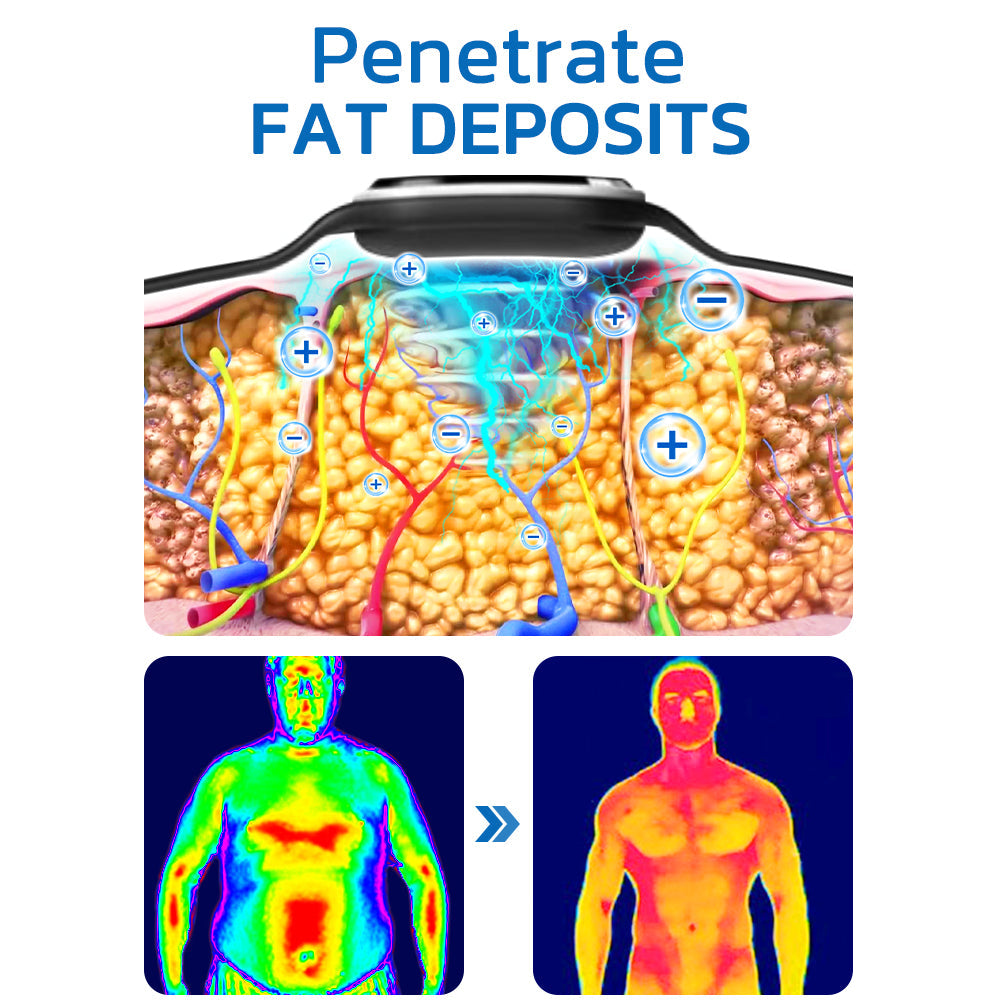 ✅HPRA Certified | 🍀GFOUK™ Ultrasonic Fat Blasting and Detoxing Wristband (🔥LAST DAY 70% OFF)