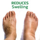 GFOUK™ GingerLegs Anti Swelling Méregtelenítő Kenőcs