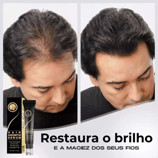 95%-os csökkenés csökkenés, 20x növekedés növekedés | Fix Your Hair®