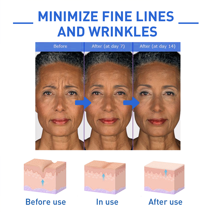 BOTOX ARCSZÉRUM | VEGYÉL 1-ET ÉS KAPSZ 1-ET INGYEN