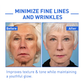 BOTOX ARCSZÉRUM | VEGYÉL 1-ET ÉS KAPSZ 1-ET INGYEN